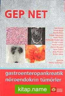 Gep Net  Gastroenteropankreatik Nöroendokrin Tümörler