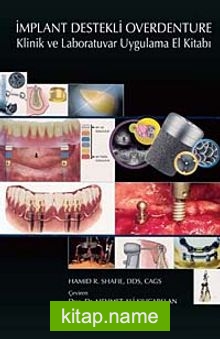 İmplant Destekli Overdenture  Klinik ve Laboratuvar Uygulama El Kitabı