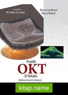 Pratik OKT El Kitabı (Retina, Koroid, Glokom)