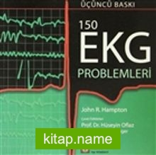 150 EKG Problemleri