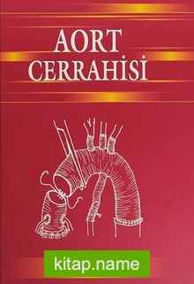 Aort Cerrahisi