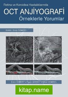 Retina ve Koroidea Hastalıklarında OCT Anjiyografi Örneklerle Yorumlar